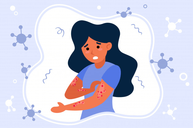 What Causes Eczema on Your Skin?